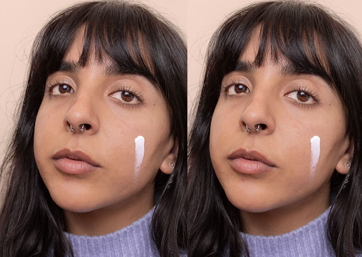 Tretinoin vs Retinol Which is Right for You 2