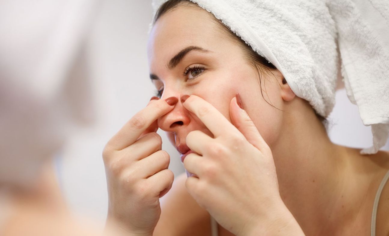 Why Popping Pimples Can Worsen Your Skin Condition 1