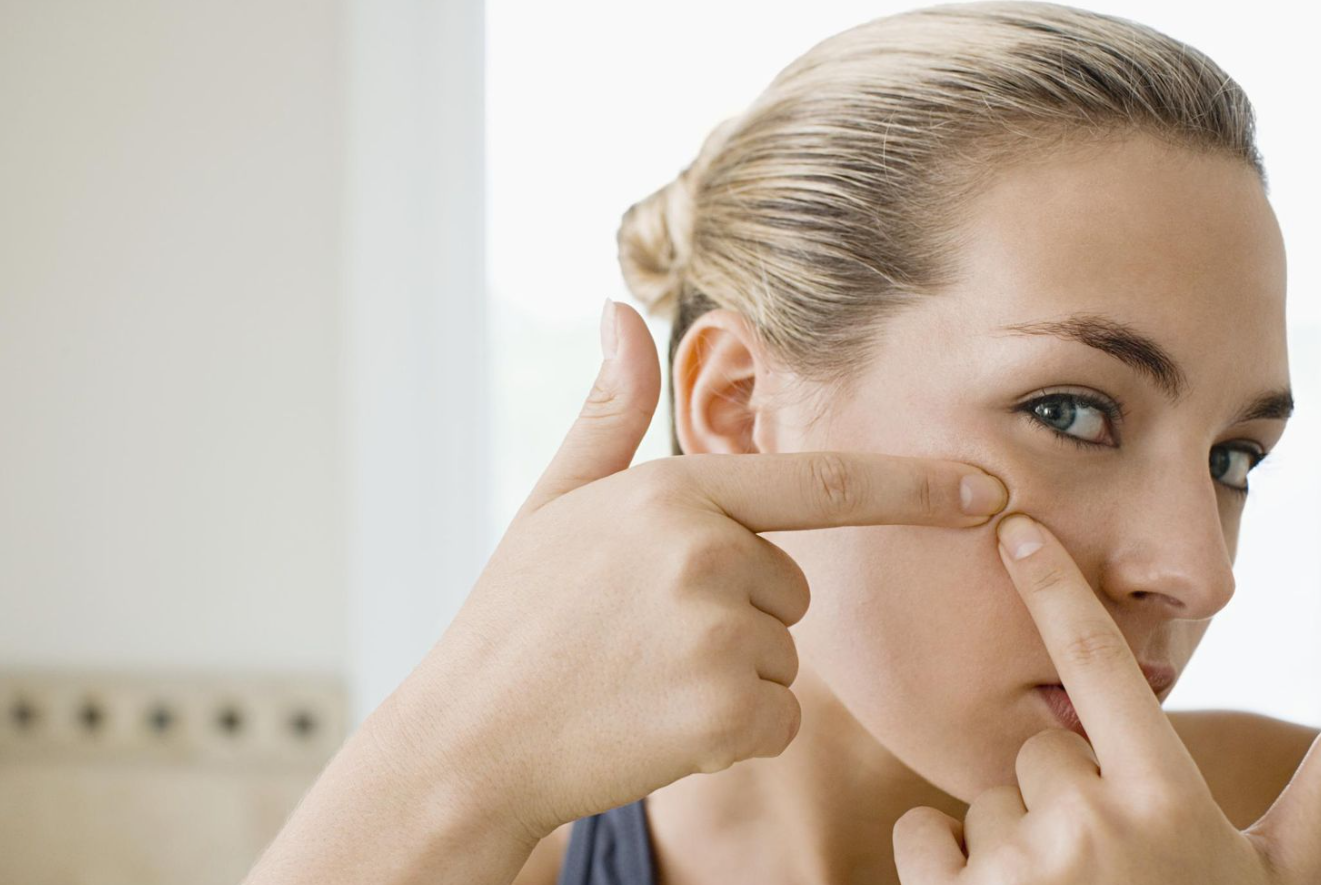 Why Popping Pimples Can Worsen Your Skin Condition 3